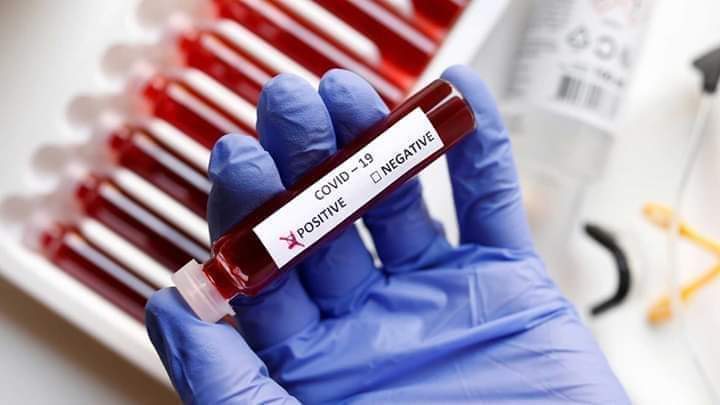 COVID-19: SALUD PÚBLICA BRINDA UN NUEVO REPORTE EPIDEMIOLÓGICO
